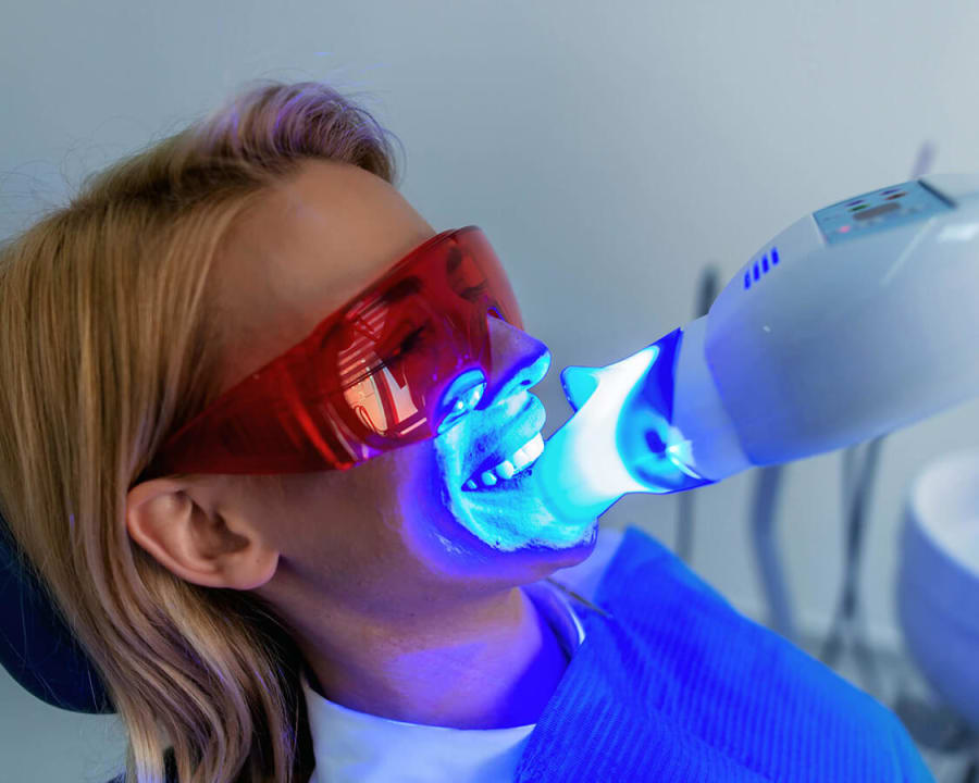 Teeth Whitening at Burnaby Dentist